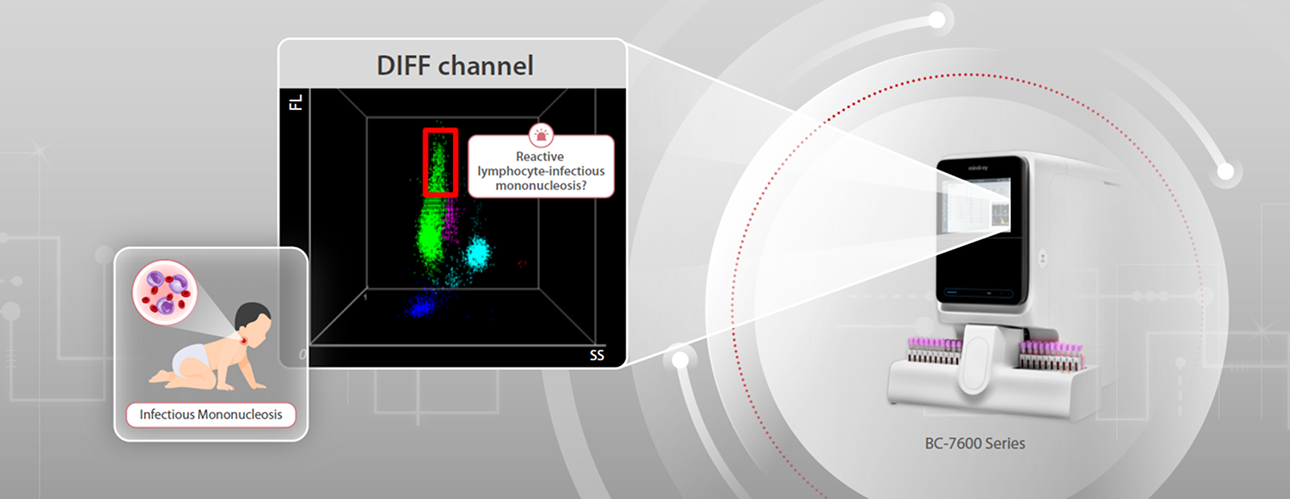 diff-channel