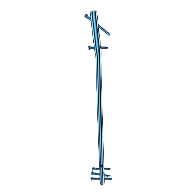 MR Femoral Nail