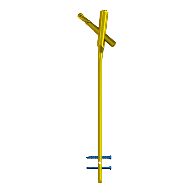 MR-IM Femoral Nail