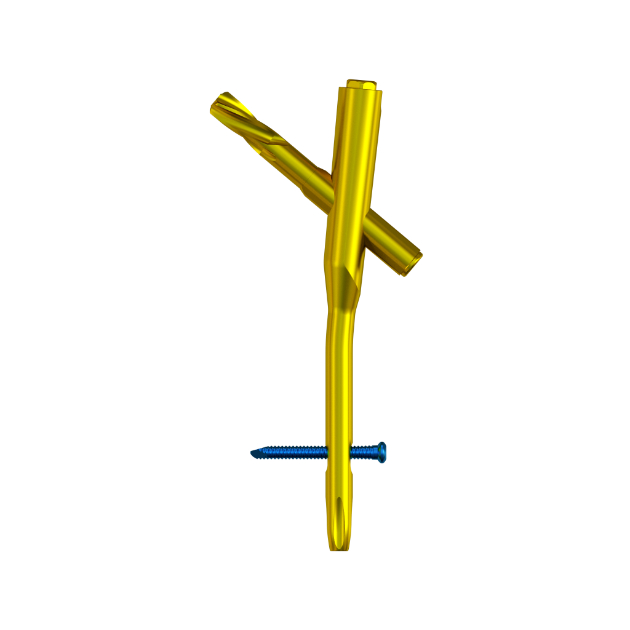 MR-IM Femoral Nail