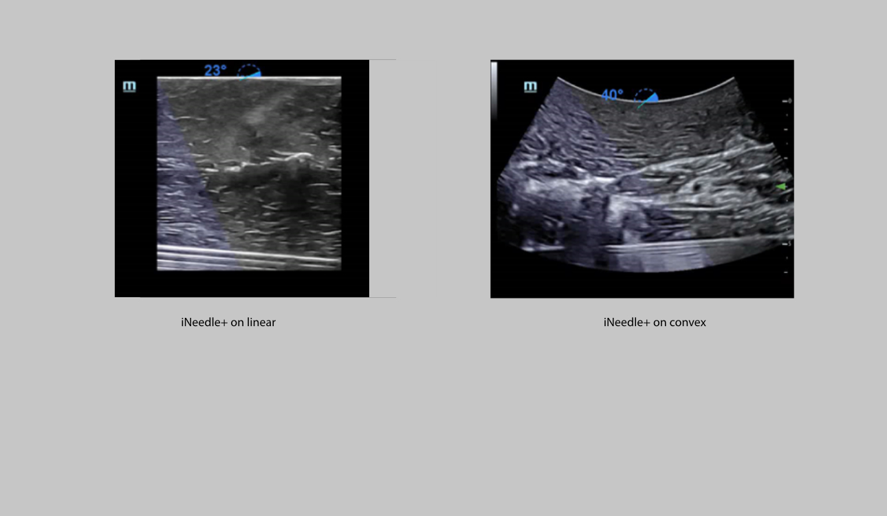 me-fig4-2-pc