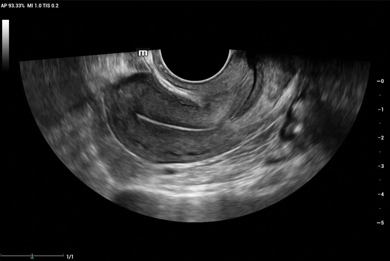 Mindray Resona I9 Ultrasound Machine