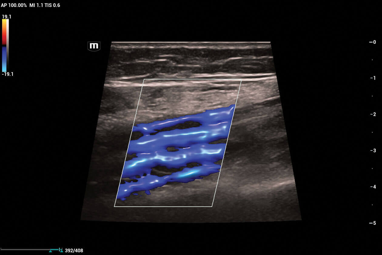 Mindray Resona I9 Ultrasound Machine