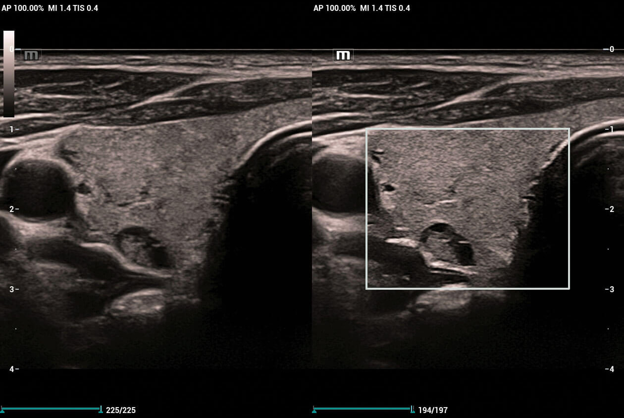 Mindray Resona I9 Ultrasound Machine