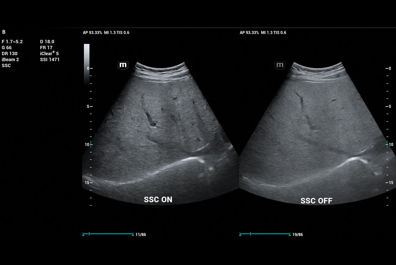 Mindray Resona I9 Ultrasound Machine