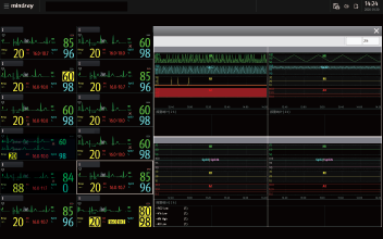 or-fig5-3-pc