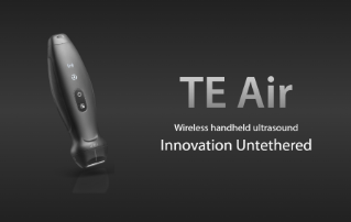 Mindray Revolutioniert die Anwendung von Ultraschall mit TE Air, Seinem Ersten Kabellosen Handheld-Ultraschallsystem