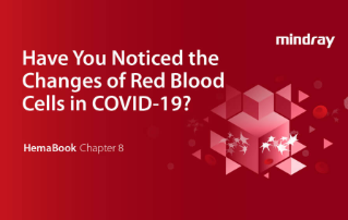 HemaBook Capítulo 8: ?Ha notado los cambios de los glóbulos rojos en COVID-19?