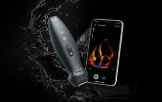 Mindray ouvre sa boutique en ligne pour son échographe portable sans fil TE?Air