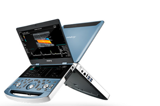 MX Series Portable Ultrasound System